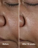 Clinique Smart Clinical Repair Wrinke Correcting Serum - Сыворотка для лица, корректирующая морщины — фото 4