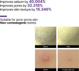 Some By Mi Retinol Intense Reactivating Serum - Сыворотка против морщин с ретинолом для чувствительной кожи — фото 7