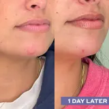 Mario Badescu Repairing Facial Spray With Hypochlorous Acid - Регенерирующий спрей для лица для смягчения — фото 8