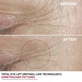 Clarins Total Eye Lift - Крем для глаз против морщин, 15 мл — фото 8
