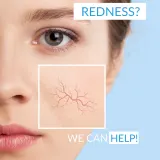 Dermedic Redness Calm - Нежная очищающая пенка, 150 мл — фото 3
