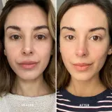Alpha-H Vitamin C - Сыворотка для лица с витамином C, осветляющая, 25 мл — фото 2