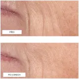 Perricone MD Cold Plasma Plus+ Treatment Sheet Mask - Маска для лица в листе, 1 шт — фото 2