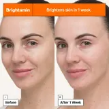 Dr. Jart+ Brightamin Brightening Serum Ampoule - Активная сыворотка для лица с витамином C, осветляющая и разглаживающая, 8.08 г — фото 3