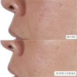 Perricone MD High Potency Face Finishing & Firming Toner - Тоник для лица, укрепляющий, 118 мл — фото 5