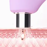 FOREO KIWI Derma - Устройство для диамантовой микродермабразии и глубокой очистки лица, 1 шт — фото 3