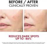 Vichy Liftactiv Pigment Specialist B3 - Сыворотка для лица против пигментации кожи, 30 мл — фото 5