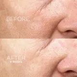 Darphin Intral Inner Youth Rescue Serum - Сыворотка успокаивающая для чувствительной кожи — фото 7