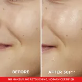 L’Oreal Paris Revitalift - Тоник для лица с эксфолирующим и очищающим действием, 180 мл — фото 5