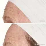 Пилинг для лица LANCER THE METHOD POLISH Oily-Congested Skin для жирной кожи, с салициловой кислотой, 120 мл — фото 3