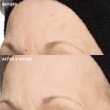 Perricone MD Cold Plasma Plus+ The Intensive Hydrating Complex - Крем интенсивного увлажнения, 30 мл — фото 2