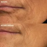 Perricone MD Cold Plasma Plus+ The Intensive Hydrating Complex - Крем интенсивного увлажнения, 30 мл — фото 3