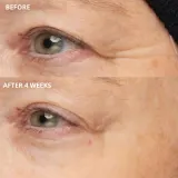 Perricone MD Cold Plasma Plus+ The Intensive Hydrating Complex - Крем интенсивного увлажнения, 30 мл — фото 4