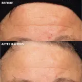 Perricone MD Cold Plasma Plus+ The Intensive Hydrating Complex - Крем интенсивного увлажнения, 30 мл — фото 6