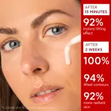 Apivita Beevine Elixir Lift Serum - Сыворотка для лица с эффектом лифтинга и упругости с осветляющим эффектом, 30 мл — фото 2