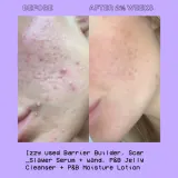 Glow Hub Purify & Brighten - Увлажняющий-осветляющий крем для лица, 95 мл — фото 3
