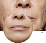 Revox B77 Retinol Cream - Антивозрастной дневной крем с SPF 20, 50 мл — фото 7