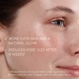 Weleda Cleansing Care Refining Toner - Тоник глубокого очищения с осветляющим эффектом, 150 мл — фото 4