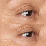 Perricone MD Hypoallergenic Clean Correction Eye Cream - Уход за кожей вокруг глаз: увлажняющий и осветляющий крем для глаз и век, уменьшающий темные круги, 15 мл — фото 5