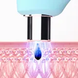 FOREO KIWI - Пылесос для удаления угрей с синим светодиодным светом, 1 шт — фото 3