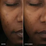 Bobbi Brown Vitamin Enriched Smoothing Serum - Сыворотка осветляющая с витамином C, 30 мл — фото 5