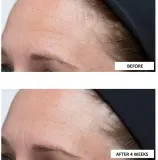 Perricone MD High Potency Classics Intensive Moisturizer - Крем интенсивного увлажнения с гиалуроновой кислотой, 30 мл — фото 5