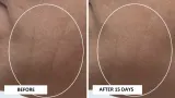 Perricone MD High Potency Classics Intensive Moisturizer - Крем интенсивного увлажнения с гиалуроновой кислотой, 30 мл — фото 6
