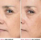 IT Cosmetics Bye Bye Lines - Сыворотка для лица с гиалуроновой кислотой, 30 мл — фото 7
