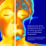 Clarins Cryo-Flash Mask - Крем для лица увлажняющий против старения и укрепляющий кожу — фото 6