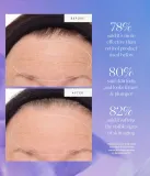 KORA Organics Plant Stem Cell Retinol Alternative Serum - Сыворотка для лица с ретинолом, 10 мл — фото 4