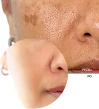 Revox B77 Skintreats Biotic Resurfacing Activator - Сыворотка с эксфолирующим эффектом для лица, разглаживающая и осветляющая, 30 мл — фото 7