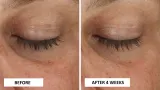 Perricone MD Cold Plasma Plus+ Eye Cream - Питательный крем для глаз против отеков и темных кругов, 15 мл — фото 5