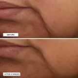 Perricone MD Essential Fx Acyl-Glutathione Moisturizer - Омолаживающий увлажняющий крем против морщин, 30 мл — фото 5