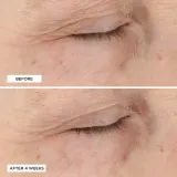 Perricone MD Essential Fx Acyl-Glutathione Moisturizer - Омолаживающий увлажняющий крем против морщин, 30 мл — фото 6