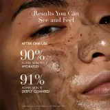 Omorovicza Moor Mud Thermal Cleansing Balm - Очищающий бальзам, 50 мл — фото 4