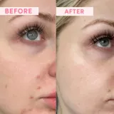 Sand & Sky Australian Emu Apple Resurfacing Mask - Крем для лица, разглаживающий для восстановления поверхности кожи, 60 г — фото 3
