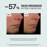 Saffee SensiDerm Soothing Relief Cream - Крем для лица для сухой и чувствительной кожи, 50 мл — фото 4
