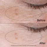 Neutrogena Collagen Bank - Гель-крем против отеков и темных кругов под глазами, 15 г — фото 5