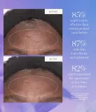 KORA Organics Plant Stem Cell Retinol Alternative Moisturizer - Увлажняющий крем с ретинолом, 15 мл — фото 4