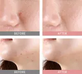 Mizon Good Bye Blemish Pink Spot - Сыворотка с порошком для местного применения против прыщей, 19 мл — фото 4