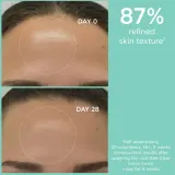 Apivita Just Bee Clear Pore Minimizing Lotion - Очищение кожи, демакияж: Забиги на розшерзоне поры и заскорники, 200 мл — фото 4