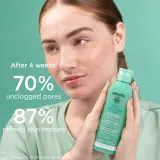Apivita Just Bee Clear Pore Minimizing Lotion - Очищение кожи, демакияж: Забиги на розшерзоне поры и заскорники, 200 мл — фото 7