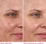 IT Cosmetics Hello Results - Пилинг для лица с гликолевой кислотой, 30 мл — фото 5