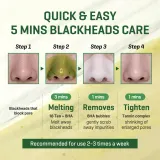 Some By Mi Bye Bye Blackhead 30 Days Miracle Green Tea Tox Bubble Cleanser - Активная пенка для очищения кожи от прыщей, 120 г — фото 8