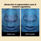 Some By Mi Yuja Niacin Anti Blemish Daily Mask - Маска для лица, осветляющая ткань для выравнивания тона кожи duże opakowanie, 30 шт — фото 8