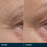 Elemis Pro-Collagen Future Restore Serum - Сыворотка для лица с эффектом упругости и осветления, 30 мл — фото 7