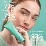 Apivita Just Bee Clear Blemish Control Moisturizer - Увлажняющий крем для лица с ниацинамидом, 40 мл — фото 5