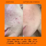 Glow Hub The Scar Slayer - Сыворотка осветляющая против пигментных пятен на коже, 30 мл — фото 2