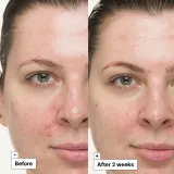 Dr. Jart+ Cicapair So Soothing Treatment - Крем для лица, устраняющий покраснения, 30 мл — фото 5