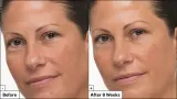 Dr. Jart+ Prejuvenation Cream with Bakuchiol - Крем регенерирующий и укрепляющий против признаков старения, 50 мл — фото 8